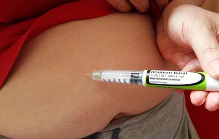 Insulin1