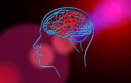 Stroke